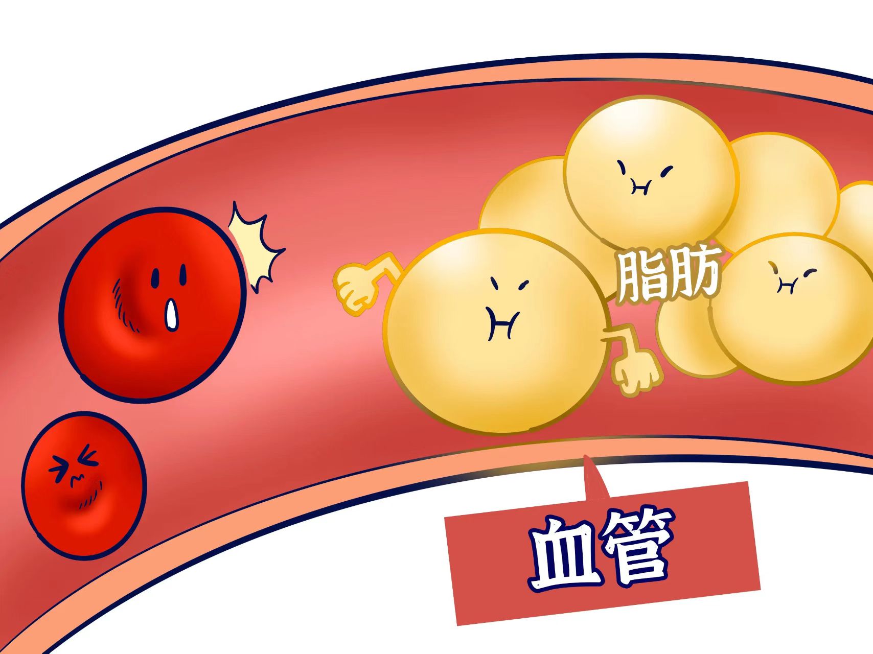 高血脂是什么原因引起的？金康道夫可以改善高血脂吗？